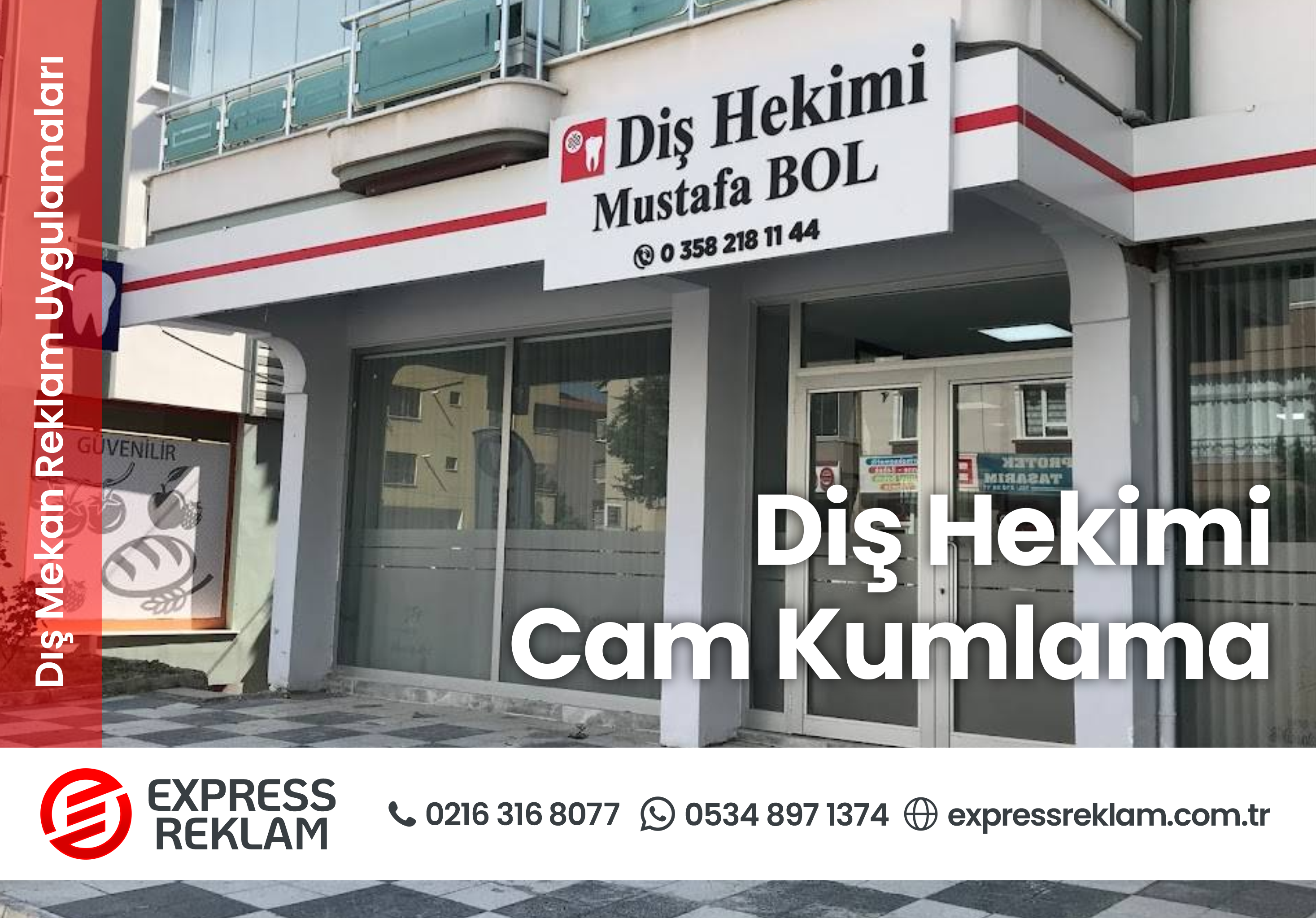Read more about the article Diş Hekimi Cam Kumlama